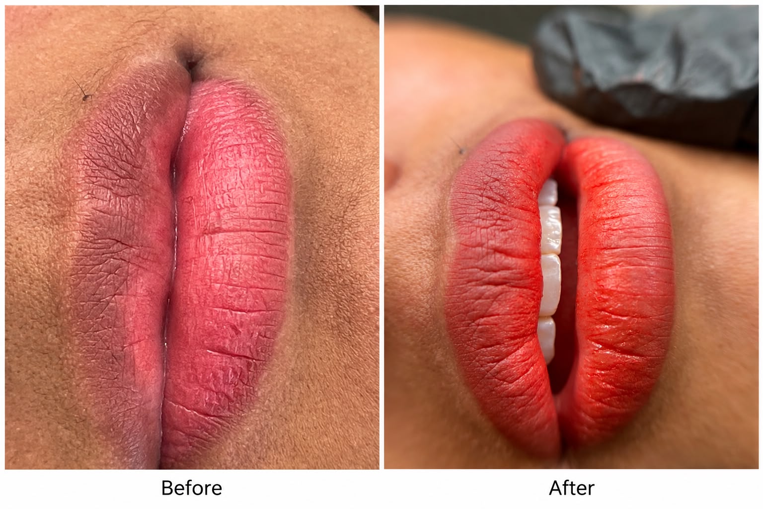 Before and after lip colour treatment