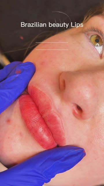 Lips immediately after a lip blush session